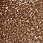 Anti-PGM1 Antibody