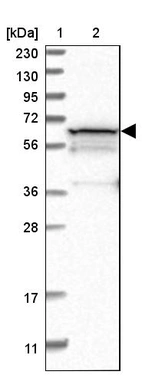 Lane 1: Marker [kDa] 230, 130, 95, 72, 56, 36, 28, 17, 11_br/_Lane 2: Human cell line RT-4