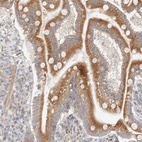 Immunohistochemical staining of human duodenum shows moderate cytoplasmic positivity in glandular cells.