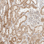 Immunohistochemical staining of human kidney shows moderate cytoplasmic positivity in cells in tubules.