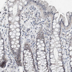 Immunohistochemical staining of human rectum shows strong positivity in nucleoli in glandular cells.