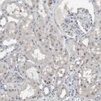 Immunohistochemical staining of human kidney shows strong positivity in nucleoli in cells in tubules.