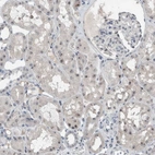 Immunohistochemical staining of human kidney shows strong positivity in nucleoli in cells in tubules.