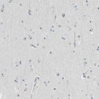 Immunohistochemical staining of human cerebral cortex shows strong positivity in nucleoli in neurons.