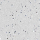 Immunohistochemical staining of human cerebral cortex shows strong positivity in nucleoli in neurons.