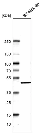 Western blot analysis in human cell line SK-MEL-30.