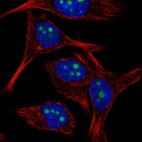 Immunofluorescent staining of human cell line SK-MEL-30 shows localization to nucleoli.