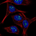 Immunofluorescent staining of human cell line SK-MEL-30 shows localization to nucleoli.