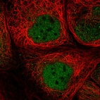 Immunofluorescent staining of human cell line A-431 shows localization to nucleoplasm.