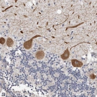 Anti-ARHGEF10 Antibody