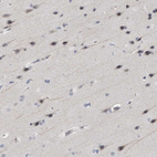 Immunohistochemical staining of human cerebral cortex shows weak cytoplasmic positivity in neurons.
