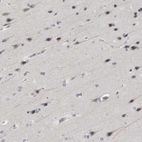 Immunohistochemical staining of human cerebral cortex shows weak cytoplasmic positivity in neurons.