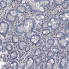 Immunohistochemical staining of human duodenum shows no cytoplasmic positivity in glandular cells as expected.