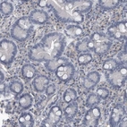Immunohistochemical staining of human duodenum shows no cytoplasmic positivity in glandular cells as expected.