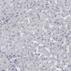 Immunohistochemical staining of human liver shows no cytoplasmic positivity in hepatocytes as expected.
