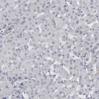 Immunohistochemical staining of human liver shows no cytoplasmic positivity in hepatocytes as expected.