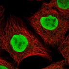 Immunofluorescent staining of human cell line A-431 shows localization to nucleoplasm.