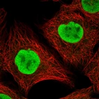 Immunofluorescent staining of human cell line A-431 shows localization to nucleoplasm.