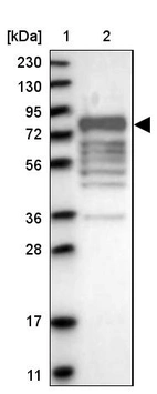 Lane 1: Marker [kDa] 230, 130, 95, 72, 56, 36, 28, 17, 11_br/_Lane 2: Human cell line RT-4