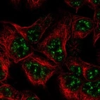 Anti-ZBTB18 Antibody