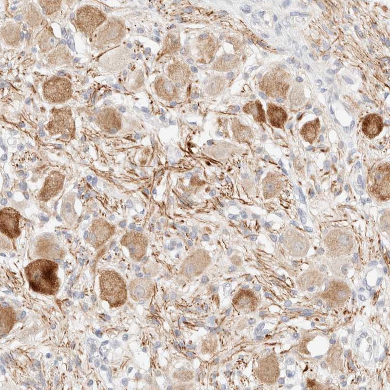 Anti-SNTB1 Antibody