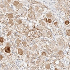 Anti-SNTB1 Antibody