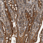 Anti-SCARA5 Antibody