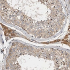 Immunohistochemical staining of human testis shows strong cytoplasmic positivity in Leydig cells.