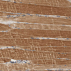 Immunohistochemical staining of human skeletal muscle shows strong cytoplasmic positivity in myocytes.