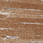 Immunohistochemical staining of human skeletal muscle shows strong cytoplasmic positivity in myocytes.