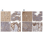 Anti-TSPOAP1 Antibody