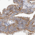 Immunohistochemical staining of human fallopian tube using Anti-TSPOAP1 antibody HPA024662.