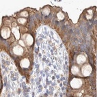 Immunohistochemical staining of human rectum using Anti-TSPOAP1 antibody HPA024662.