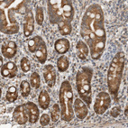 Immunohistochemical staining of human Duodenum shows moderate cytoplasmic and nuclear positivity in glandular cells.