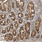 Immunohistochemical staining of human Duodenum shows moderate cytoplasmic and nuclear positivity in glandular cells.