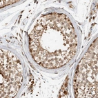 Immunohistochemical staining of human Testis shows moderate cytoplasmic and nuclear positivity in cells in seminiferous ducts and Leydig cells.