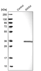 Western blot analysis in control (vector only transfected HEK293T lysate) and GINS4 over-expression lysate (Co-expressed with a C-terminal myc-DDK tag (~3.1 kDa) in mammalian HEK293T cells, LY403156).