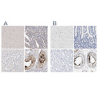 Immunohistochemical staining of human cerebral cortex, duodenum, kidney and testis using Anti-ACTL7B antibody HPA024664 (A) shows similar protein distribution across tissues to independent antibody HPA021803 (B).