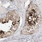 Immunohistochemical staining of human testis shows strong nuclear positivity in cells in seminiferous ducts.
