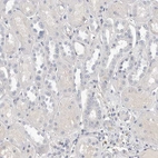 Immunohistochemical staining of human kidney shows no positivity in cells in tubules as expected.