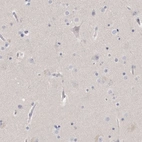 Immunohistochemical staining of human cerebral cortex shows no positivity in neurons as expected.