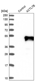 Anti-ACTL7B Antibody