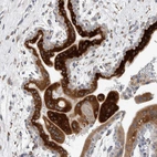 Immunohistochemical staining of human placenta shows moderate to strong cytoplasmic positivity in trophoblastic cells.