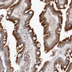 Immunohistochemical staining of human duodenum shows moderate to strong cytoplasmic positivity in glandular cells.