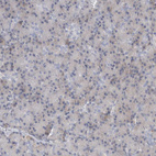 Anti-KIAA1456 Antibody