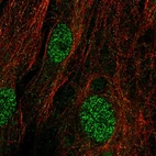 Immunofluorescent staining of human cell line BJ shows localization to nucleoplasm & cytosol.