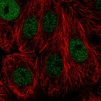 Immunofluorescent staining of human cell line MCF7 shows localization to nucleoplasm.