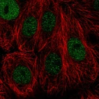 Immunofluorescent staining of human cell line MCF7 shows localization to nucleoplasm.