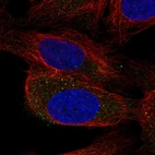 Anti-TEPSIN Antibody