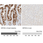 Anti-KRT20 Antibody